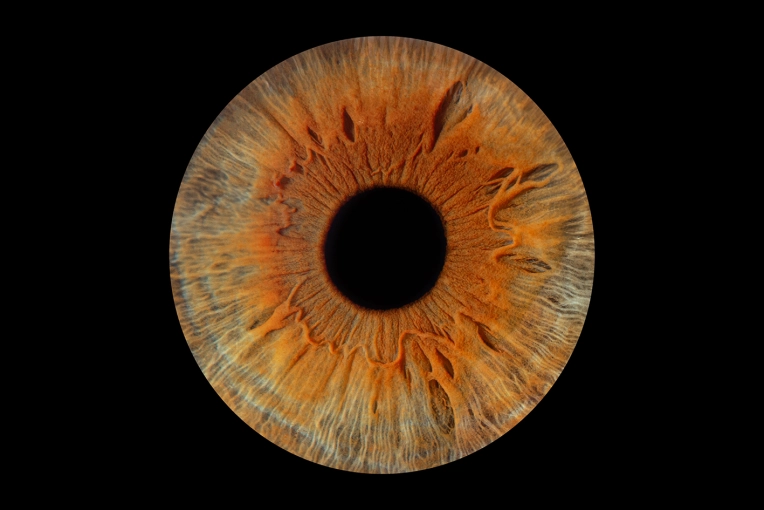 Photography, Iris, Traditional