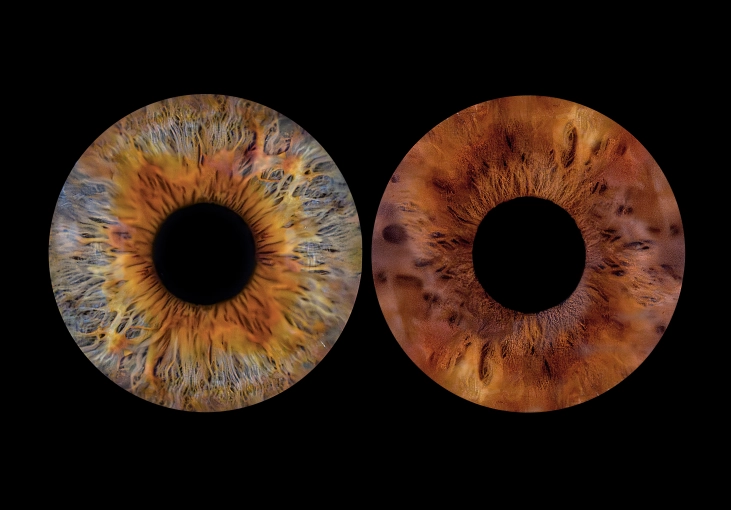 Photographie, Iris, Traditionnel