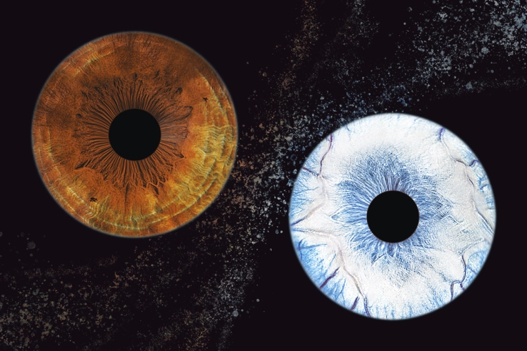 Photographie, Iris, Artistique