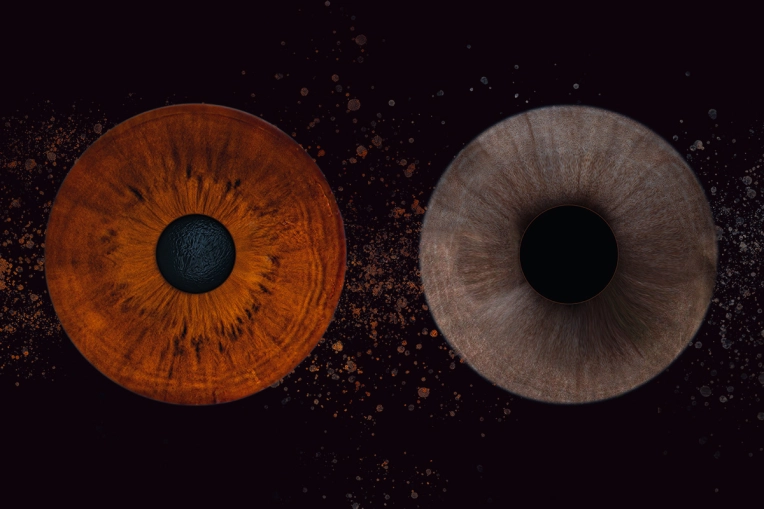 Photographie, Iris, Artistique